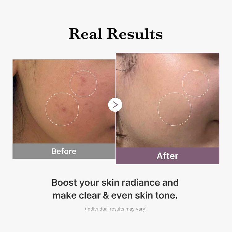 Medicube Age-r Glutatione Glow Toner 140ml