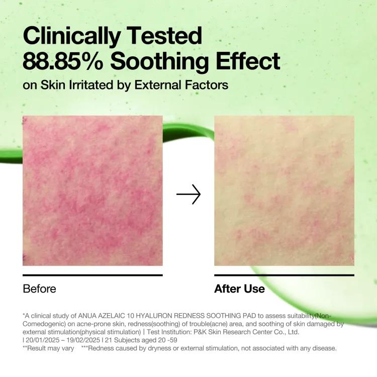 Anua Azelaic acid 10 Hyaluron Redness Soothing Pad (90ea) 230ml