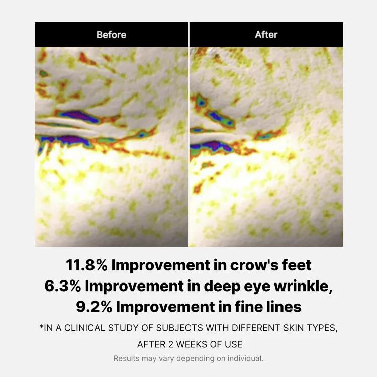 Medicube Deep Lifting Peptide Eyecream For Face 30ml
