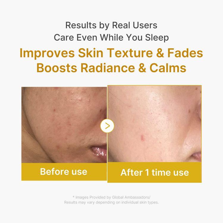 Medicube Kojic Acid Turmeric Night Wrapping Mask,75ml