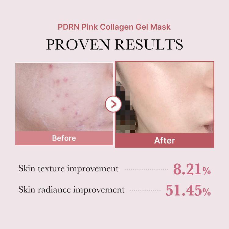 Medicube Pdrn Pink Collagen Gel Mask 28g