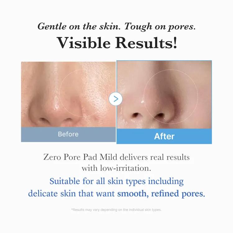 Medicube Zero Pore Pad Mild (70pcs),155g